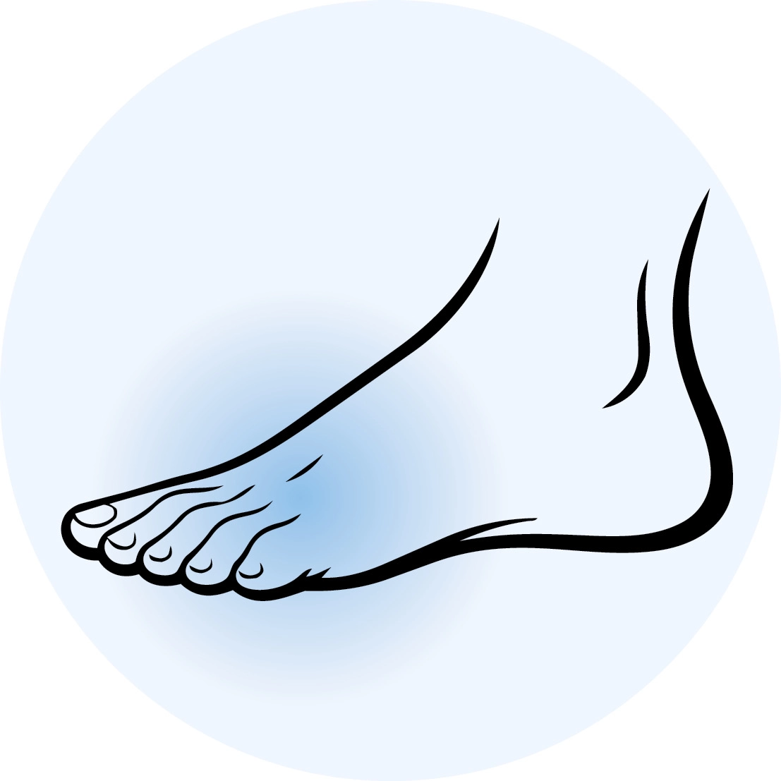 Wolky Schuhe für Hammerzehen